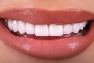 Know Everything About Dental Filling