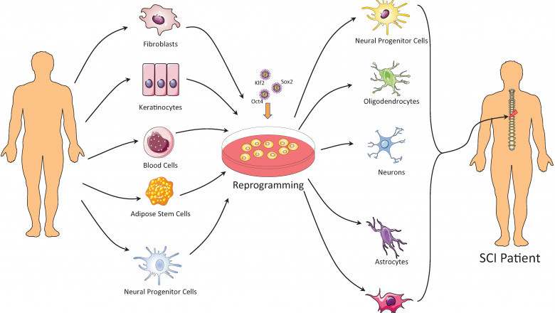The Adipose Derived Stem Cell Therapy Market: Global Industry Trends, Size, Growth, Opportunity, and Forecast 2022-2028