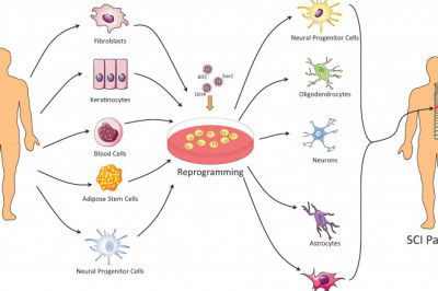 The Adipose Derived Stem Cell Therapy Market: Global Industry Trends, Size, Growth, Opportunity, and Forecast 2022-2028