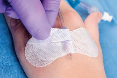 The Catheter Stabilization Devices Market: Global industry trends, share, size, growth, opportunities, and forecasts for 2022-2028