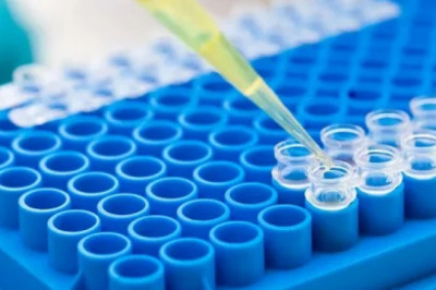 The Laboratory Accessories Market: Global industry trends, share, size, growth, opportunities, and forecasts for 2022-2028