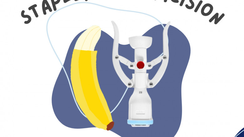 What should you know about Circumcision services Kuala Lumpur?