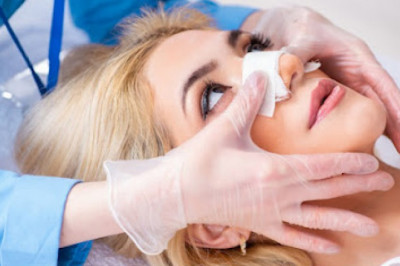 Why do Nasal fractures happen?