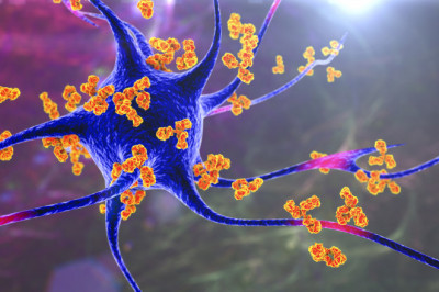 Autoimmune Disease Treatment Market Emerging Demands, Size & Revenue, Business Prospects to 2028