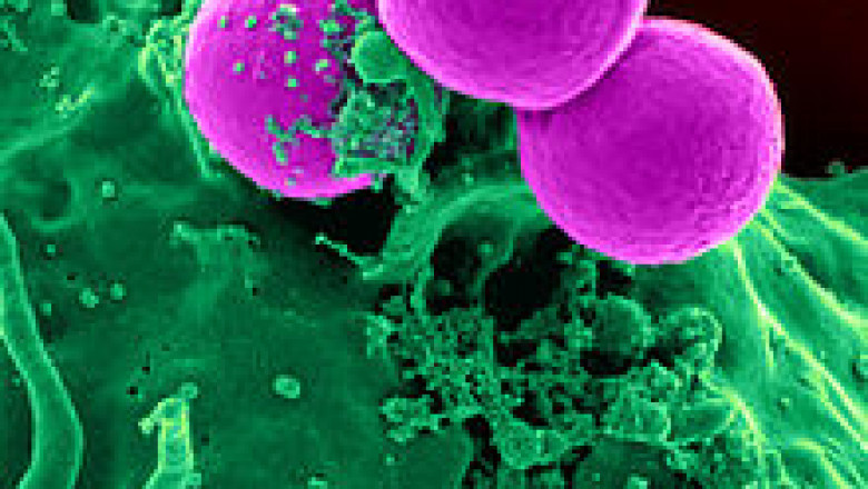 Global Methicillin Resistant Staphylococcus Aureus Treatment Market Current Trends and Future Aspect Analysis Report 2021–2028
