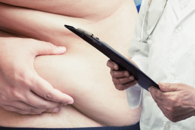 How Can Gastric Sleeve Surgery Help You Shed Pounds?