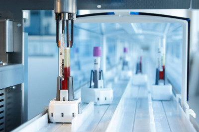 A study of the global Automated Liquid Handling Systems Market : trends, market size, growth, opportunity, as well as forecasts for 2022-2028