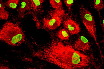 Global Mesenchymal Stem Cells Market Analysis