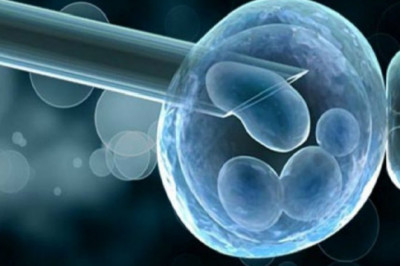 Global Preimplantation Genetic Diagnosis Market Analysis
