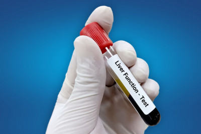 Significance of Liver Function Test