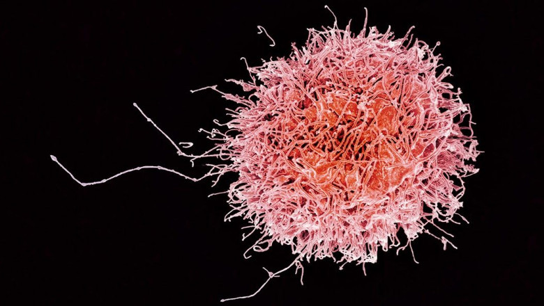A natural killer cell is capable of killing its target cells because it is cytotoxic in nature
