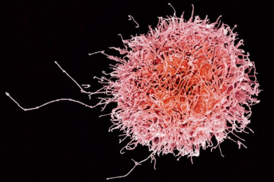 A natural killer cell is capable of killing its target cells because it is cytotoxic in nature