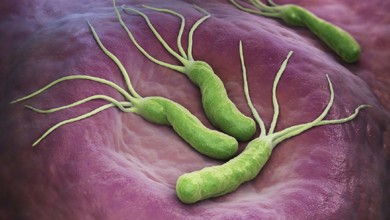 A study of the global Helicobacter Pylori Diagnostics Market : trends, market size, growth, opportunity, as well as forecasts for 2026