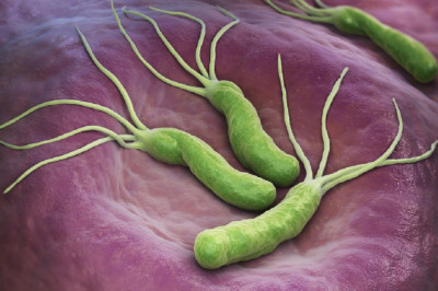 A study of the global Helicobacter Pylori Diagnostics Market : trends, market size, growth, opportunity, as well as forecasts for 2026