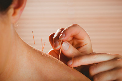 Acupuncture For Pain Relief