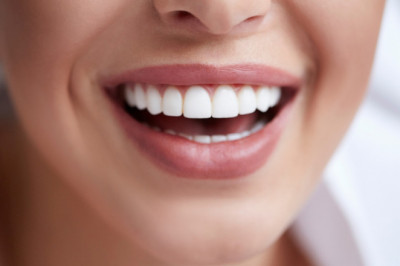 Hollywood Smile: a guide with everything you need to know about it.