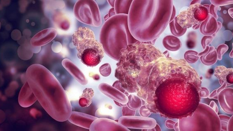 Hormone Refractory Breast Cancer Market (2022 - 2029) with Trends, Outlook & Forecast