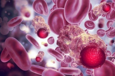 Hormone Refractory Breast Cancer Market (2022 - 2029) with Trends, Outlook & Forecast