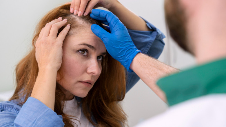 What are the 5 common hair problems during winter?