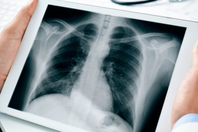X-Rays Market is Booming Across the Globe by Share, Size, Growth, Segments and Forecast 2030