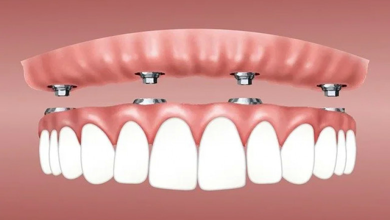 Best dentist in sion East