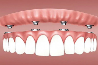Best dentist in sion East
