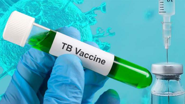 As A Defensive Measure Against Tuberculosis (TB) Infection, Tuberculosis Vaccine Is Used