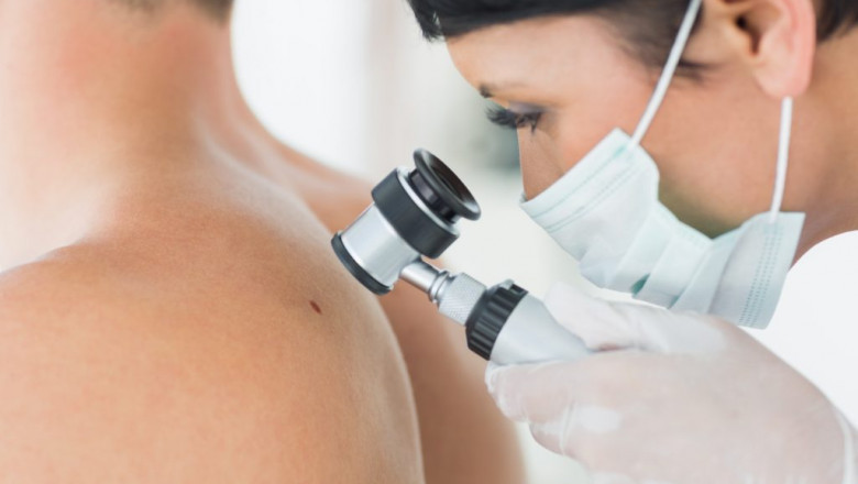 Even Though Melanoma Treatment Is Among The Deadliest Forms Of Skin Cancer, Promising New Treatments Are Improving Quality Of Life And Improving Survival Rates