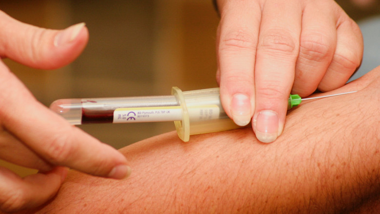 Needle Guidance System Market Insights, and Upcoming Business Opportunities 2030