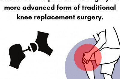 Robotic knee replacement doctors in India