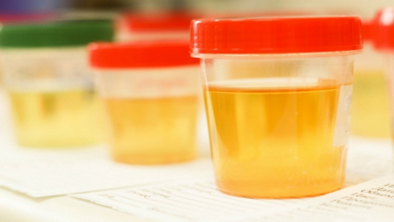 Things to Keep in Mind When Purchasing Synthetic Urine