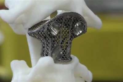 Things to know about 3D Printed Medical Devices