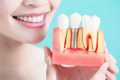 What Are The Symptoms Of Periodontitis Diseases?