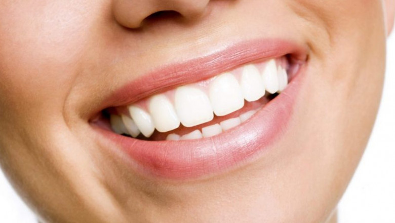 What Is Periodontitis?