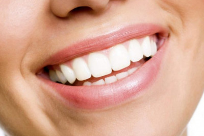 What Is Periodontitis?