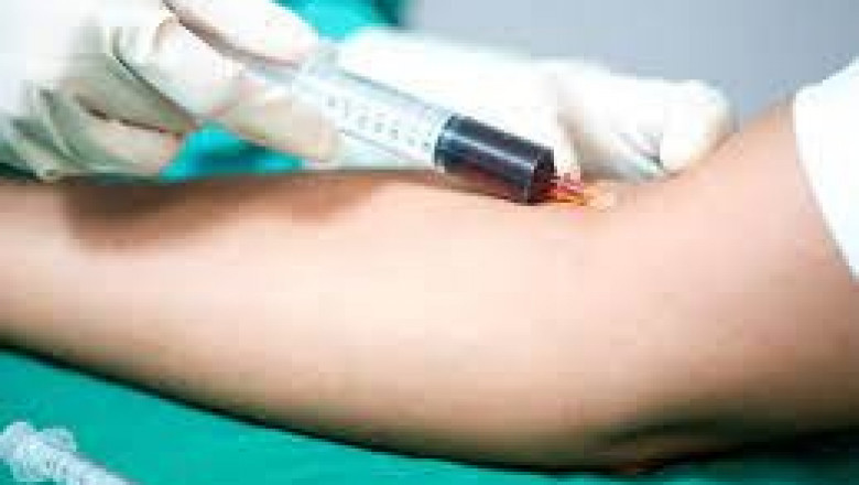 Blood Culture Tests Market Size, Share & Forecast | USD 10,009.0 million by 2030