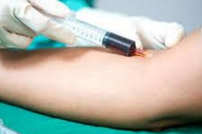 Blood Culture Tests Market Size, Share & Forecast | USD 10,009.0 million by 2030