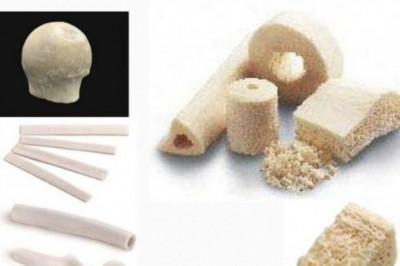 Bone Grafts Substitutes Market to Reach US$  3.5 million by 2030