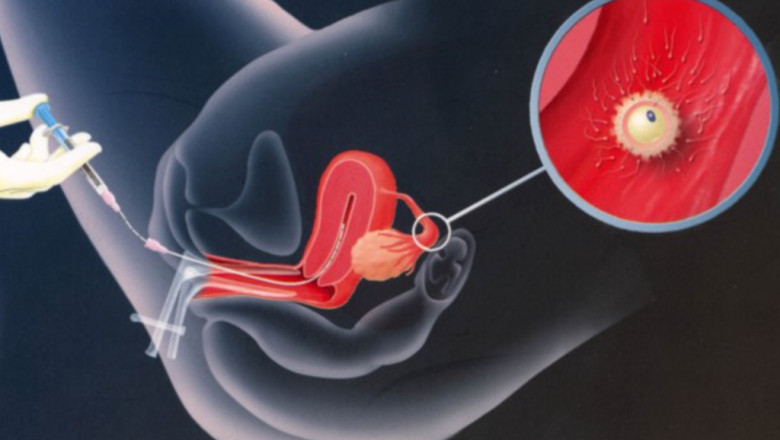 How does Artificial Insemination Work?