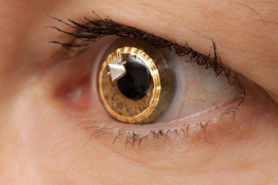 Things to know about the Artificial Retina