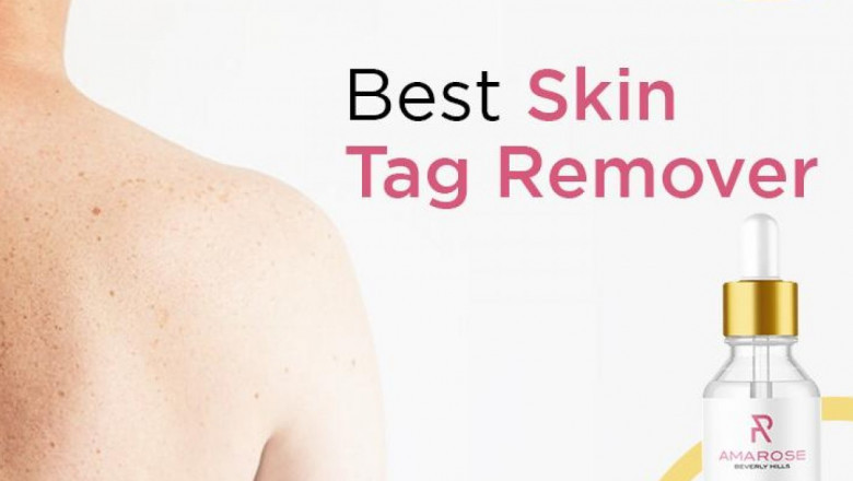 Don’t Think Too Much While Choosing Amarose Skin Tag Remover