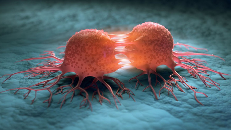 A Solid Tumor Is Formed When Cell Divide Constantly, Causing A Mass Of Abnormal Cells To Fill The Bloodstream