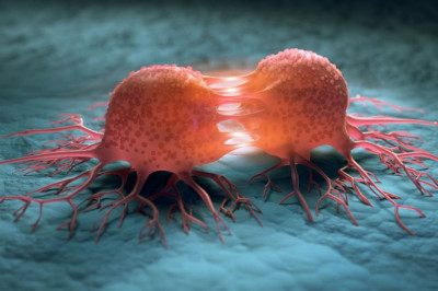 A Solid Tumor Is Formed When Cell Divide Constantly, Causing A Mass Of Abnormal Cells To Fill The Bloodstream