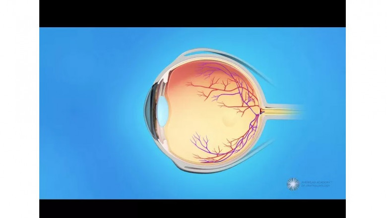 Choosing the Best Eye Facility: Some Advice