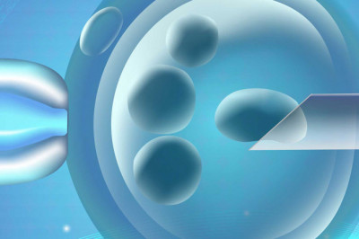 Global Preimplantation Genetic Diagnosis Market Overview