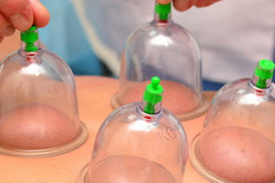 Cupping Therapy: The Best Pain Relief Therapy